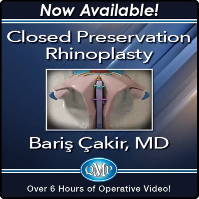 Closed Preservation Rhinoplasty by Baris Çakir, MD - Image 2