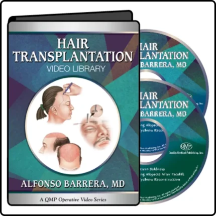 Hair Transplantation