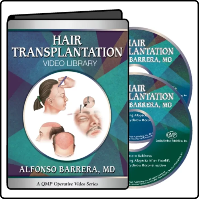 Hair Transplantation