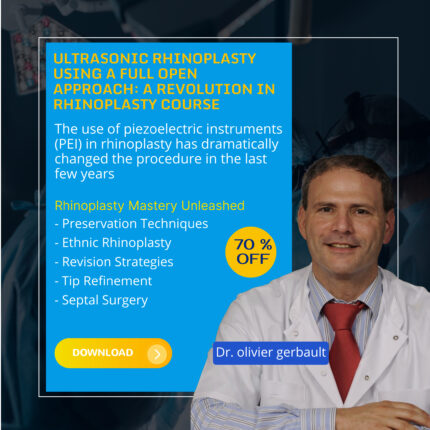 Ultrasonic Rhinoplasty Using a Full Open Approach: A Revolution in Rhinoplasty