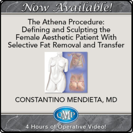 The Athena Procedure: Defining and Sculpting the Female Aesthetic Patient With Selective Fat Removal and Transfer