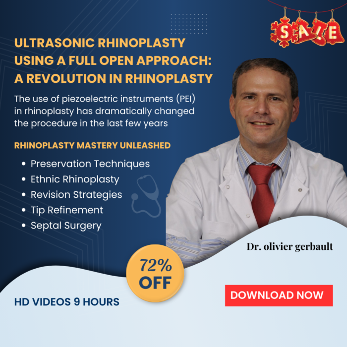 Ultrasonic Rhinoplasty Using a Full Open Approach: A Revolution in Rhinoplasty - Image 2
