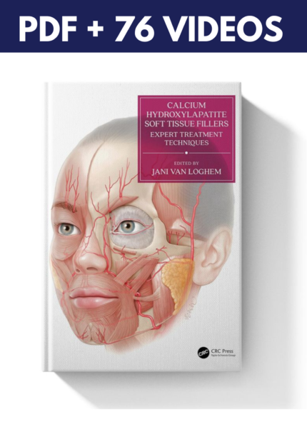 Calcium Hydroxylapatite Soft Tissue Fillers (Book & Videos)