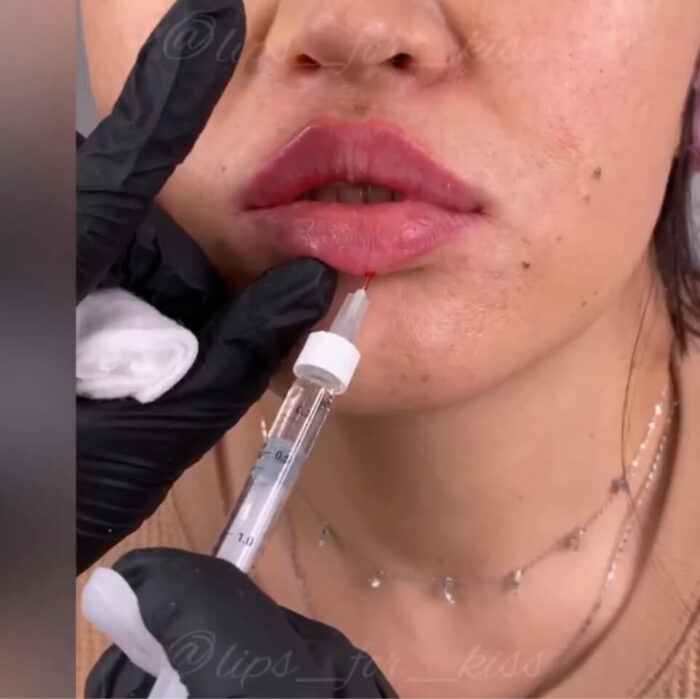Lips for Kiss Course VIP Pack + Full Pack (GIFT) - Image 11