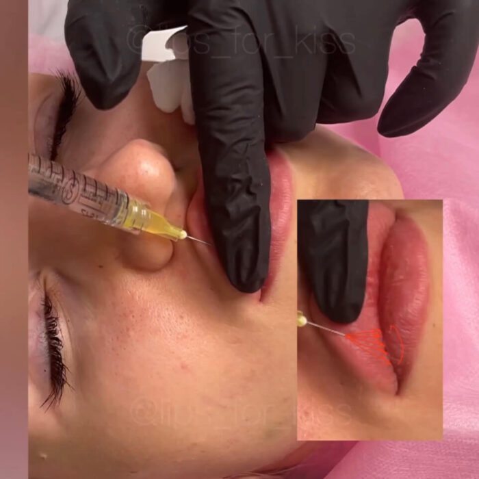 Lips for Kiss Course VIP Pack + Full Pack (GIFT) - Image 4