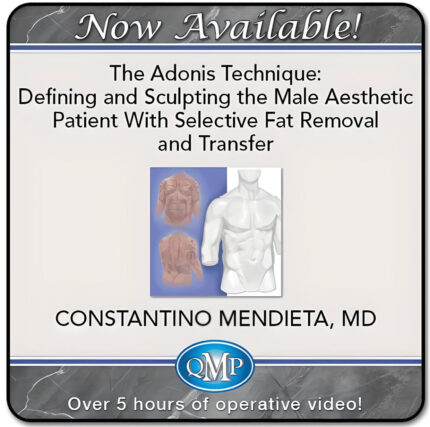 The Adonis Technique Defining and Sculpting the Male Aesthetic Patient With Selective Fat Removal and Transfer 2025