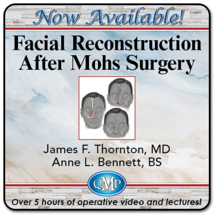 QMP Facial Reconstruction After Mohs Surgery 2024