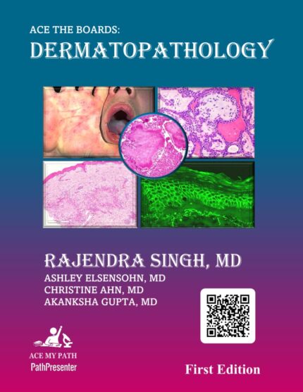 Ace The Boards: Dermatopathology (Ace My Path)