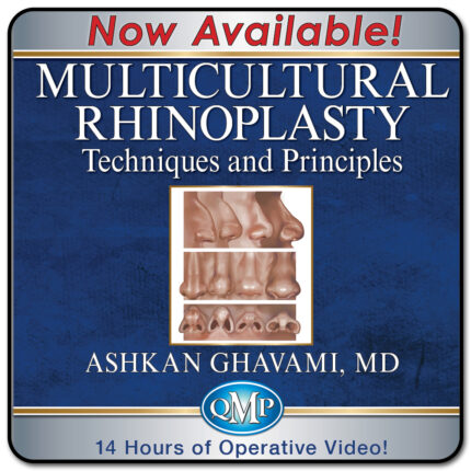 QMP Multicultural Rhinoplasty: Techniques and Principles