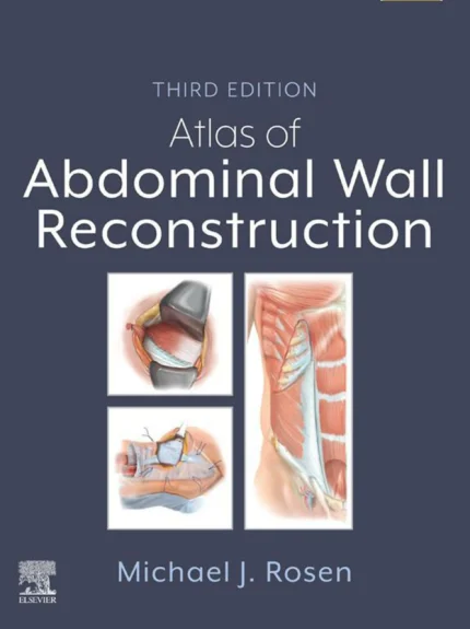 Atlas of Abdominal Wall Reconstruction, 3rd Edition (Original PDF)