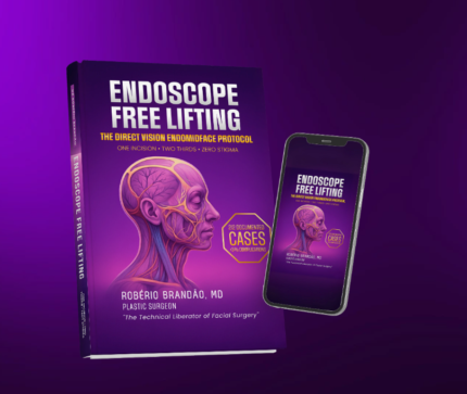 Endoscope-Free Lifting: The Direct Vision Endomidface Protocol