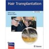 Hair Transplantation, 6th Edition by Robin Unger & Ronald Shapiro - Thieme