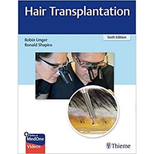 Hair Transplantation, 6th Edition by Robin Unger & Ronald Shapiro - Thieme