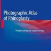 Photographic Atlas of Rhinoplasty: Problem-solving and Troubleshooting by Sureyya Seneldir