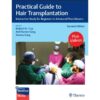 Practical Guide to Hair Transplantation by True, Garg & Garg
