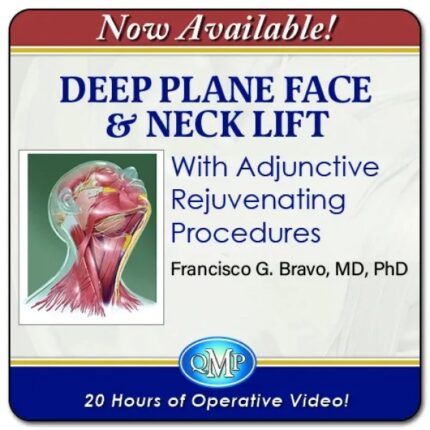 QMP Deep Plane Face & Neck Lift With Adjunctive Rejuvenating Procedures 2025 - Francisco Bravo MD